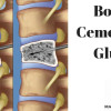 Bone Cement & Glue Market