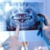 Dental Radiography Market